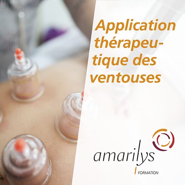 application des ventouses