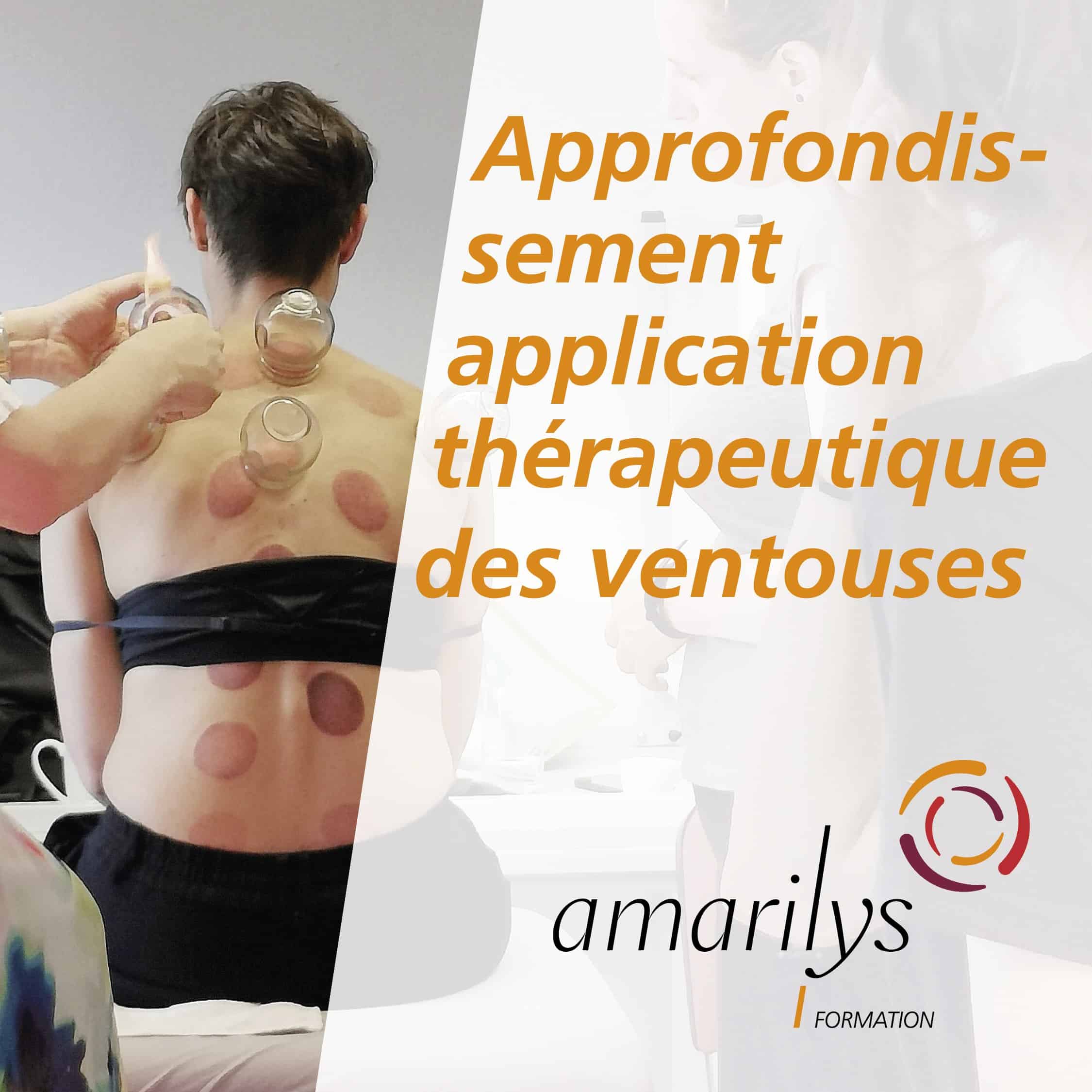 approfondissement des ventouses