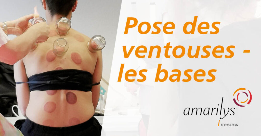 pose des ventouses les bases